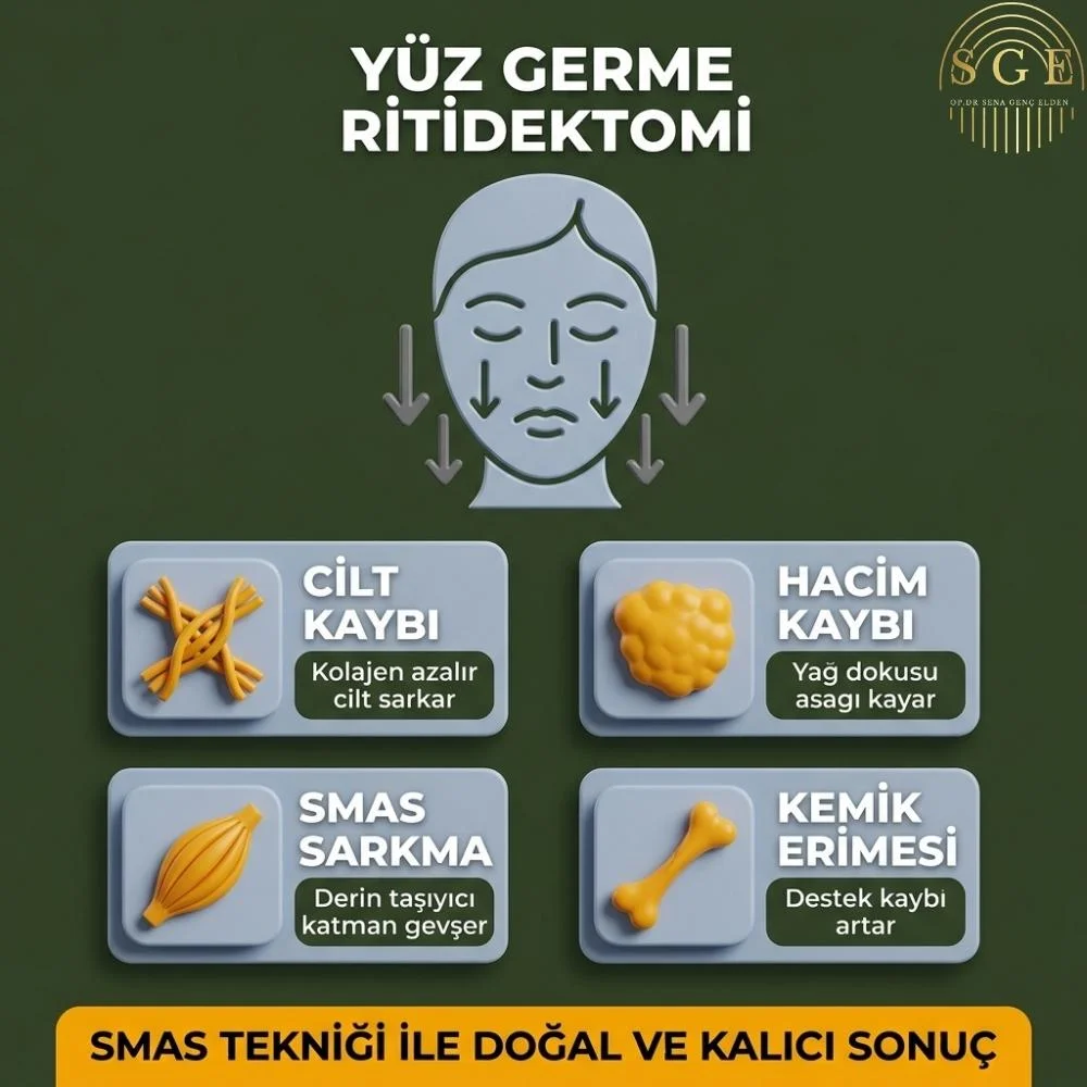 En iyi yüz germe yöntemi nedir Sakarya